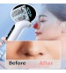 Micro Bubble Face Cleaner Water Circulation Vacuum Suction Blackhead Remover